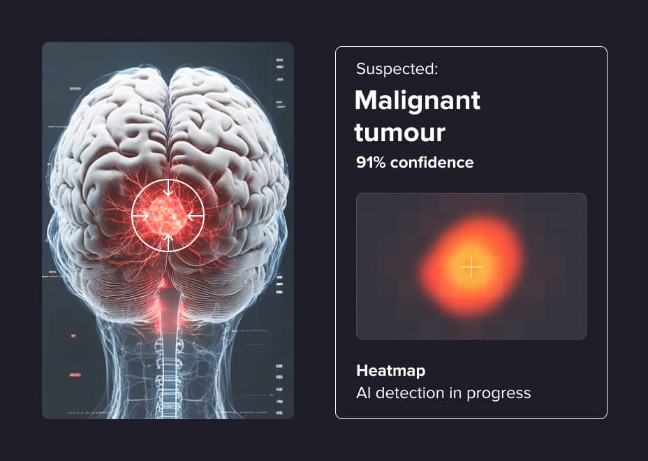 Example of how AI detects a tumour