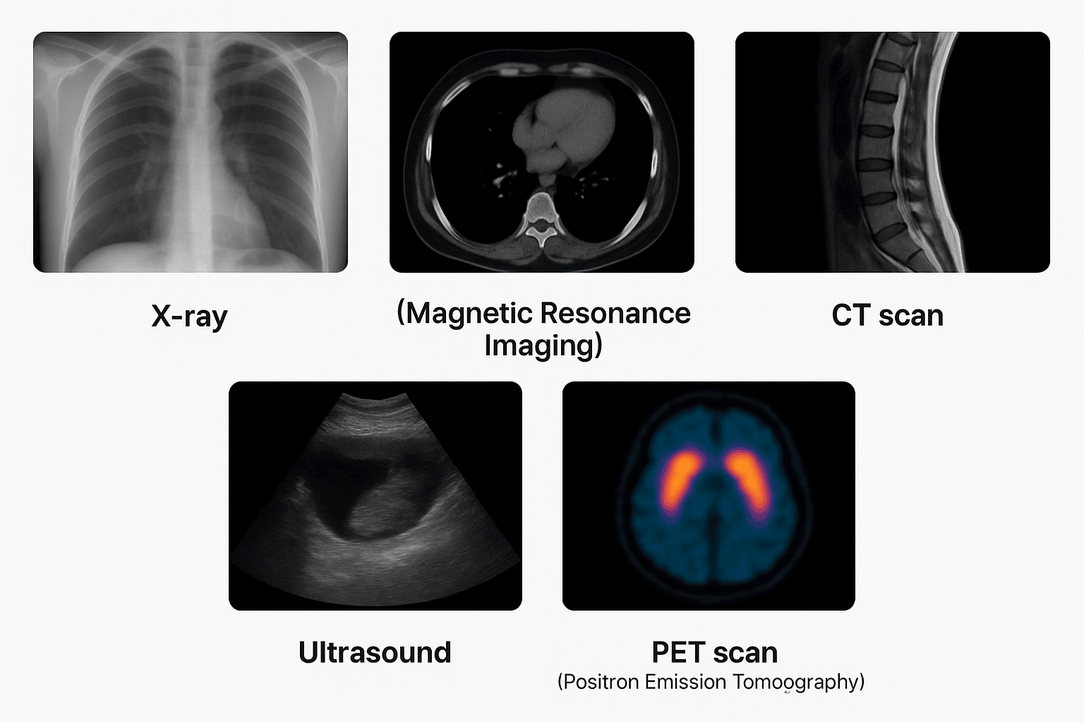 Medical imaging techniques
